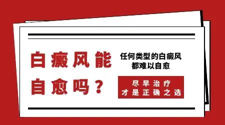 白斑膏